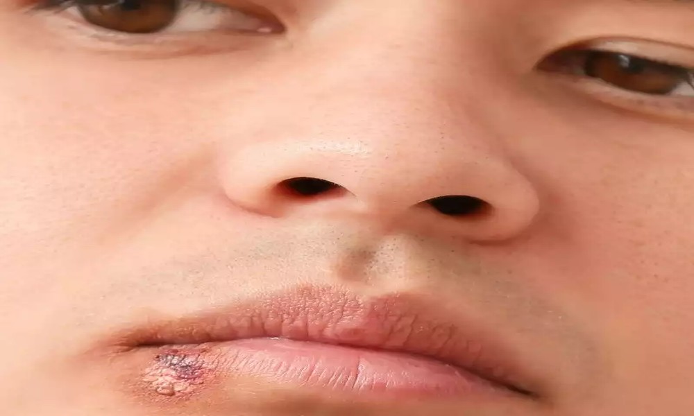 Image default
